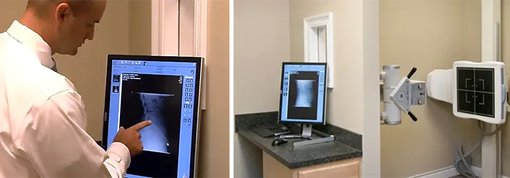 Chiropractor Pensacola FL J. Blake Gilmore X-Ray